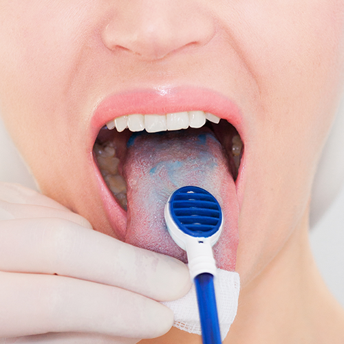 bild-zungensauger-prozess-auftragen